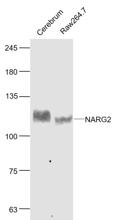 Lane 1: Rat Cerebrum lysates; Lane 2: RAW264.7 cell lysates probed with NARG2 Polyclonal Antibody, Unconjugated (bs-5968R) at 1:1000 dilution and 4˚C overnight incubation. Followed by conjugated secondary antibody incubation at 1:20000 for 60 min at 37˚C.