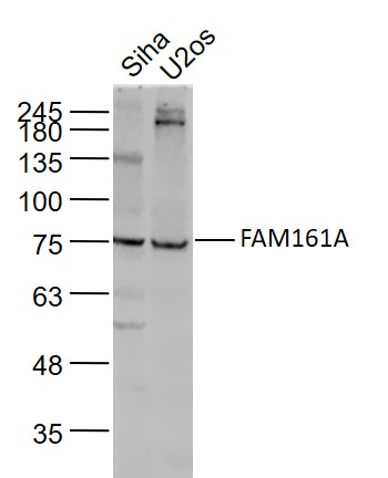 Lane 1: Siha cell lysates; Lane 2: U2os cell lysates probed with FAM161A Polyclonal Antibody, Unconjugated (bs-8216R) at 1:1000 dilution and 4˚C overnight incubation. Followed by conjugated secondary antibody incubation at 1:20000 for 60 min at 37˚C.