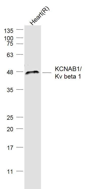 Rat heart lysates probed with KCNAB1 Polyclonal Antibody, Unconjugated (bs-8691R) at 1:1000 dilution and 4˚C overnight incubation. Followed by conjugated secondary antibody incubation at 1:20000 for 60 min at 37˚C.