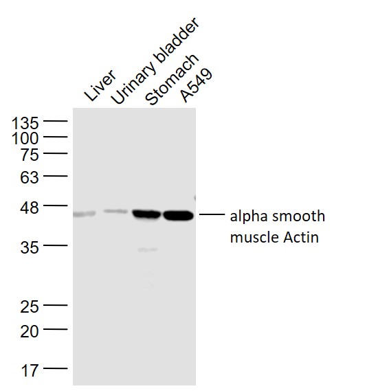 Lane 1: Rat Liver lysates; Lane 2: Rat Urinary bladder lysates; Lane 3: Mouse Stomach lysates; Lane 4: A549 cell lysates probed with Pan-Actin Polyclonal Antibody, Unconjugated (bs-10196R) at 1:1000 dilution and 4˚C overnight incubation. Followed by conjugated secondary antibody incubation at 1:20000 for 60 min at 37˚C.