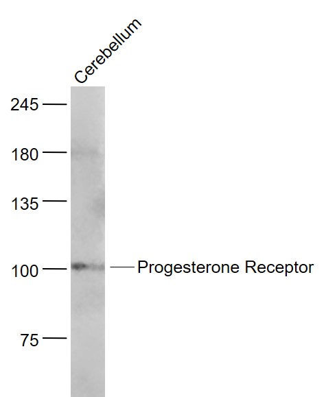 Mouse cerebllumlysates probed with Progesterone Receptor Polyclonal Antibody, Unconjugated (bs-23376R) at 1:1000 dilution and 4˚C overnight incubation. Followed by conjugated secondary antibody incubation at 1:20000 for 60 min at 37˚C.