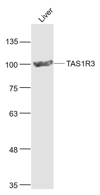 Mouse liver lysates probed with TAS1R3 Polyclonal Antibody, Unconjugated (bs-23618R) at 1:1000 dilution and 4˚C overnight incubation. Followed by conjugated secondary antibody incubation at 1:20000 for 60 min at 37˚C.