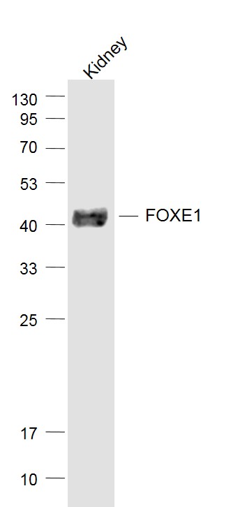 Mouse kidney lysates probed with FOXE1 Polyclonal Antibody, Unconjugated (bs-0446R) at 1:1000 dilution and 4˚C overnight incubation. Followed by conjugated secondary antibody incubation at 1:20000 for 60 min at 37˚C.