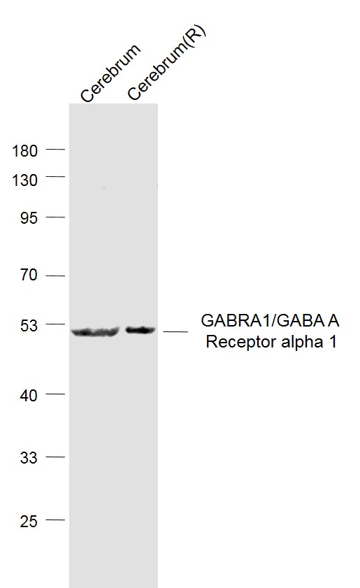 Lane 1: Mouse Cerebrum lysates; Lane 2:Rat Cerebllum lysates probed with GABA A Receptor alpha 1 Polyclonal Antibody, Unconjugated (bs-1232R) at 1:1000 dilution and 4˚C overnight incubation. Followed by conjugated secondary antibody incubation at 1:20000 for 60 min at 37˚C.