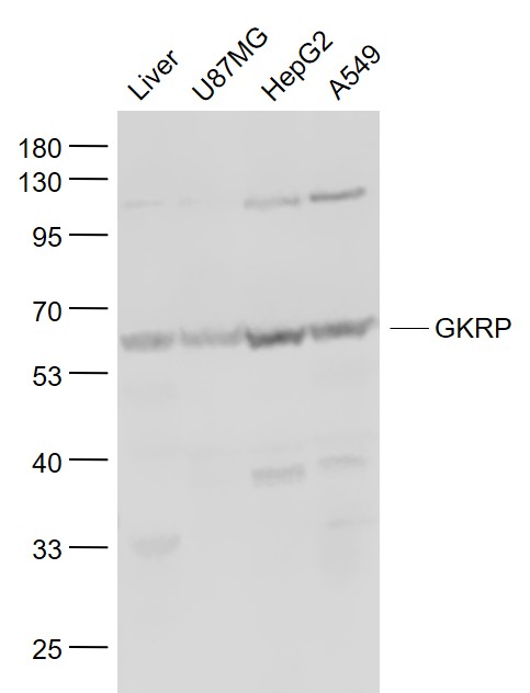 Lane 1: Mouse Liver lysates; Lane 2: U87MG cell lysates; Lane 3: HepG2 cell lysates; Lane 4: A549 cell lysates probed with GKRP Polyclonal Antibody, Unconjugated (bs-2356R) at 1:1000 dilution and 4˚C overnight incubation. Followed by conjugated secondary antibody incubation at 1:20000 for 60 min at 37˚C.