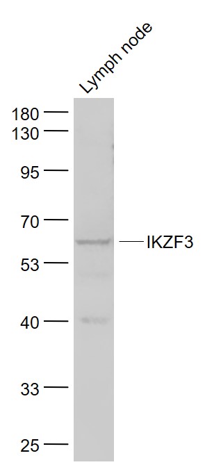 Mouse lymph node lysates probed with IKZF3 Polyclonal Antibody, Unconjugated (bs-2954R) at 1:1000 dilution and 4˚C overnight incubation. Followed by conjugated secondary antibody incubation at 1:20000 for 60 min at 37˚C.