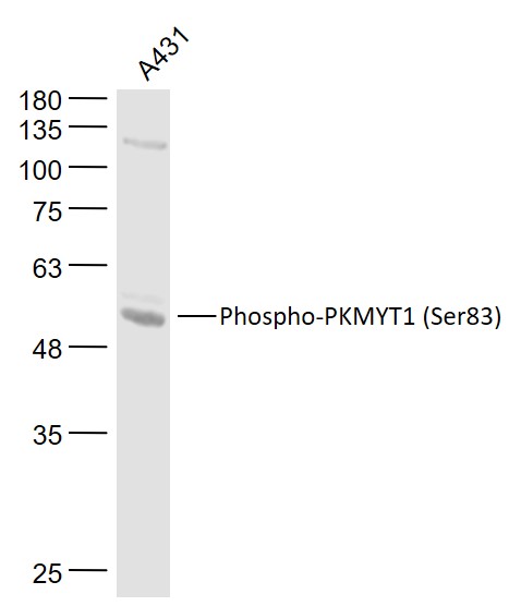 A431 cell lysates probed with Myt1 (Ser83) Polyclonal Antibody, Unconjugated (bs-3296R) at 1:1000 dilution and 4˚C overnight incubation. Followed by conjugated secondary antibody incubation at 1:20000 for 60 min at 37˚C.
