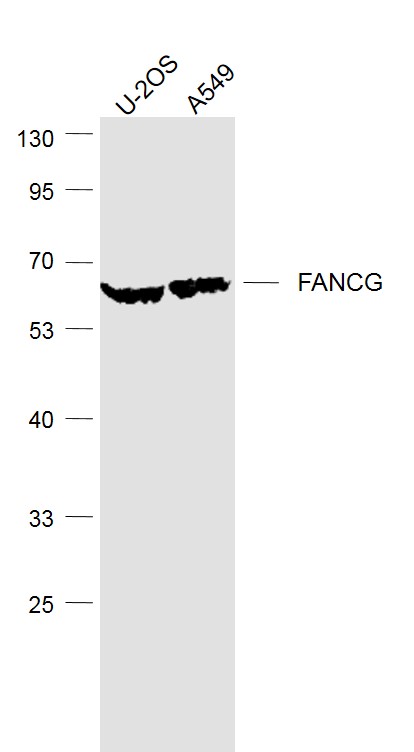 Lane 1: U2os cell lysates; Lane 2: A549 cell lysates probed with FANCG Polyclonal Antibody, Unconjugated (bs-4106R) at 1:1000 dilution and 4˚C overnight incubation. Followed by conjugated secondary antibody incubation at 1:20000 for 60 min at 37˚C. Lane 1: U2os cell lysates; Lane 2: A549 cell lysates probed with FANCG Polyclonal Antibody, Unconjugated (bs-4106R) at 1:1000 dilution and 4˚C overnight incubation. Followed by conjugated secondary antibody incubation at 1:20000 for 60 min at 37˚C.