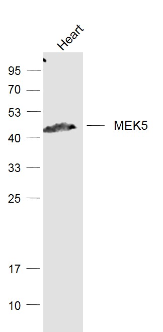 Mouse heart lysates probed with MEK5 Polyclonal Antibody, Unconjugated (bs-4124R) at 1:1000 dilution and 4˚C overnight incubation. Followed by conjugated secondary antibody incubation at 1:20000 for 60 min at 37˚C.