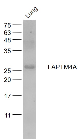 Mouse lung lysates probed with LAPTM4A Polyclonal Antibody, Unconjugated (bs-9562R) at 1:1000 dilution and 4˚C overnight incubation. Followed by conjugated secondary antibody incubation at 1:20000 for 60 min at 37˚C.