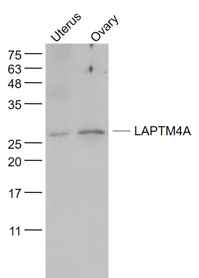 Lane 1: Mouse Uterus lysates; Lane 2: Mouse Ovary lysates probed with LAPTM4A Polyclonal Antibody, Unconjugated (bs-9562R) at 1:1000 dilution and 4˚C overnight incubation. Followed by conjugated secondary antibody incubation at 1:20000 for 60 min at 37˚C.