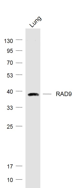 Mouse lung lysates probed with RAD9 Polyclonal Antibody, Unconjugated (bs-4179R) at 1:1000 dilution and 4˚C overnight incubation. Followed by conjugated secondary antibody incubation at 1:20000 for 60 min at 37˚C.