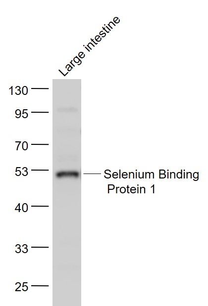 Mouse large intestine lysates probed with Selenium Binding Protein 1 Polyclonal Antibody, Unconjugated (bs-4200R) at 1:1000 dilution and 4˚C overnight incubation. Followed by conjugated secondary antibody incubation at 1:20000 for 60 min at 37˚C.