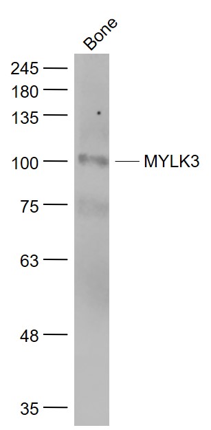 Mouse bone lysates probed with MYLK3 Polyclonal Antibody, Unconjugated (bs-9865R) at 1:1000 dilution and 4˚C overnight incubation. Followed by conjugated secondary antibody incubation at 1:20000 for 60 min at 37˚C.