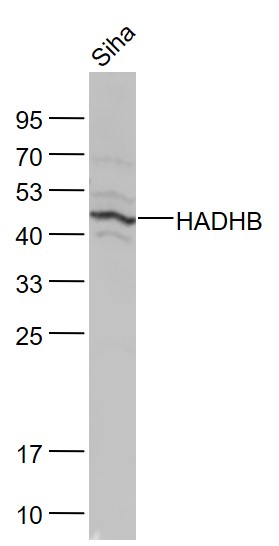 Lane 1: Siha cell lysates probed with HADHB Polyclonal Antibody, Unconjugated (bs-5065R) at 1:1000 dilution and 4˚C overnight incubation. Followed by conjugated secondary antibody incubation at 1:20000 for 60 min at 37˚C.