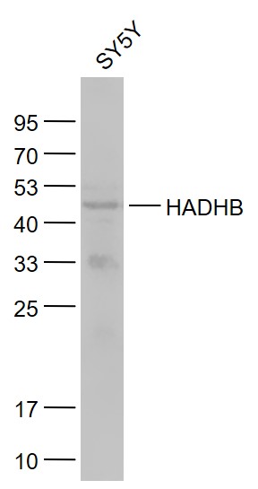 Lane 1: SY5Y cell lysates probed with HADHB Polyclonal Antibody, Unconjugated (bs-5065R) at 1:1000 dilution and 4˚C overnight incubation. Followed by conjugated secondary antibody incubation at 1:20000 for 60 min at 37˚C.