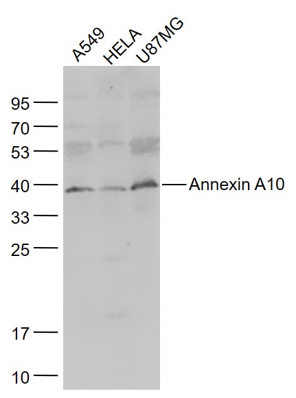 Lane 1: A549 cell lysates; Lane 2: Hela cell lysates; Lane 3: U87MG cell lysates probed with Annexin A10 Polyclonal Antibody, Unconjugated (bs-5127R) at 1:1000 dilution and 4°C overnight incubation. Followed by conjugated secondary antibody incubation at 1:20000 for 60 min at 37°C.