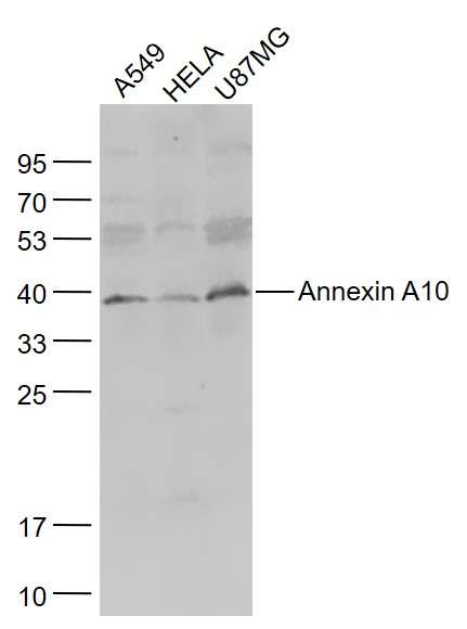 Lane 1: A549 cell lysates; Lane 2: Hela cell lysates; Lane 3: U87MG cell lysates probed with Annexin A10 Polyclonal Antibody, Unconjugated (bs-5127R) at 1:1000 dilution and 4˚C overnight incubation. Followed by conjugated secondary antibody incubation at 1:20000 for 60 min at 37˚C.