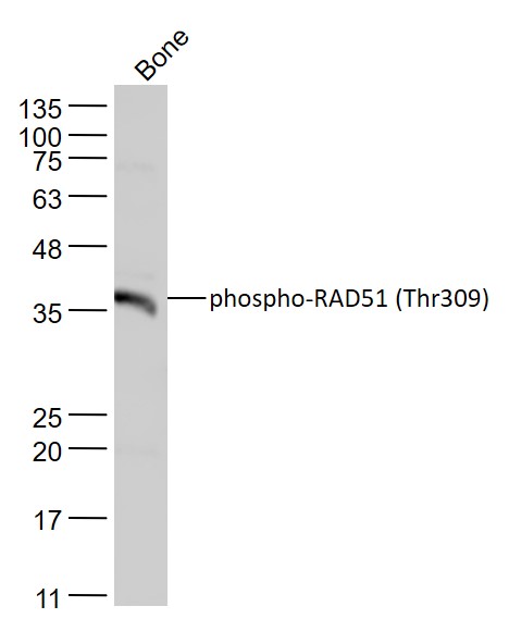 Mouse bone lysates probed with RAD51(Thr309) Polyclonal Antibody, Unconjugated (bs-5677R) at 1:1000 dilution and 4˚C overnight incubation. Followed by conjugated secondary antibody incubation at 1:20000 for 60 min at 37˚C.