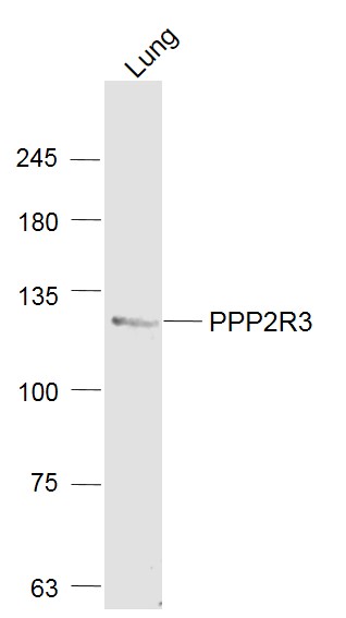 Mouse lung lysates probed with PPP2R3 Polyclonal Antibody, Unconjugated (bs-5759R) at 1:1000 dilution and 4˚C overnight incubation. Followed by conjugated secondary antibody incubation at 1:20000 for 60 min at 37˚C.