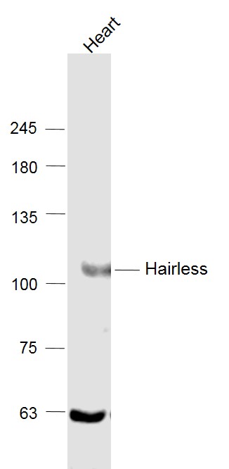 Mouse heart lysates probed with USP28 Polyclonal Antibody, Unconjugated (bs-5820R) at 1:1000 dilution and 4˚C overnight incubation. Followed by conjugated secondary antibody incubation at 1:20000 for 60 min at 37˚C.