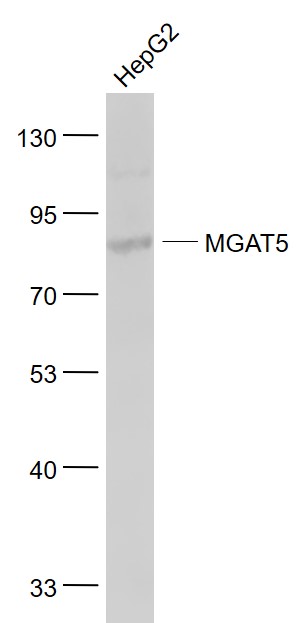 HepG2 cell lysates probed with MGAT5 Polyclonal Antibody, Unconjugated (bs-5841R) at 1:1000 dilution and 4˚C overnight incubation. Followed by conjugated secondary antibody incubation at 1:20000 for 60 min at 37˚C.