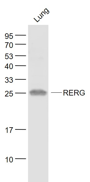 Mouse lung lysates probed with RERG Polyclonal Antibody, Unconjugated (bs-6091R) at 1:1000 dilution and 4˚C overnight incubation. Followed by conjugated secondary antibody incubation at 1:20000 for 60 min at 37˚C.