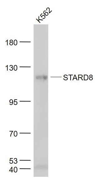 K562 cell lysates probed with STARD8 Polyclonal Antibody, Unconjugated (bs-6159R) at 1:1000 dilution and 4˚C overnight incubation. Followed by conjugated secondary antibody incubation at 1:20000 for 60 min at 37˚C.