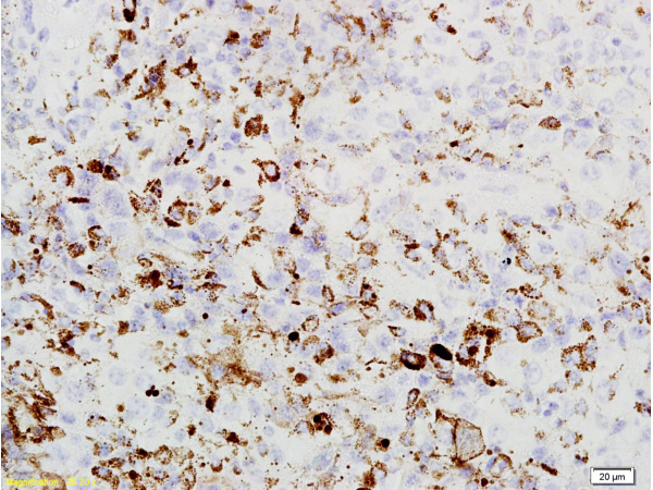 Formalin-fixed and paraffin embedded mouse lung labeled with Rabbit Anti PRAME Polyclonal Antibody, Unconjugated (bs-7004R) at 1:200 followed by conjugation to the secondary antibody and DAB staining
