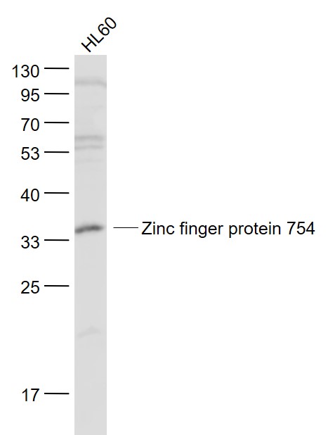 HL60 cell lysates probed with Zinc finger protein 754 Polyclonal Antibody, Unconjugated (bs-6347R) at 1:1000 dilution and 4˚C overnight incubation. Followed by conjugated secondary antibody incubation at 1:20000 for 60 min at 37˚C.