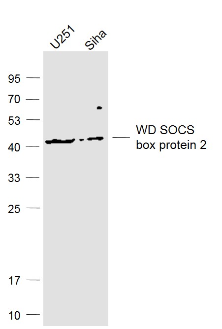 Lane 1: U251 cell lysates; Lane 2: Siha cell lysates probed with WD SOCS box protein 2 Polyclonal Antibody, Unconjugated (bs-6752R) at 1:1000 dilution and 4˚C overnight incubation. Followed by conjugated secondary antibody incubation at 1:20000 for 60 min at 37˚C.