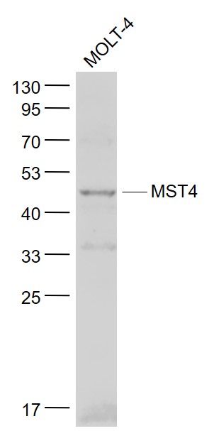 Molt-4 cell lysates probed with MST4 Polyclonal Antibody, Unconjugated (bs-6782R) at 1:1000 dilution and 4˚C overnight incubation. Followed by conjugated secondary antibody incubation at 1:20000 for 60 min at 37˚C.