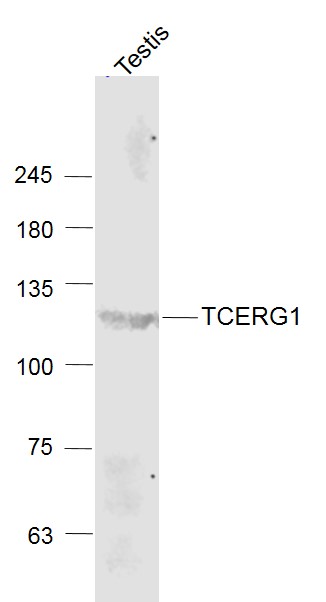 Mouse Molt-4 cell lysates probed with TCERG1 Polyclonal Antibody, Unconjugated (bs-6801R) at 1:1000 dilution and 4˚C overnight incubation. Followed by conjugated secondary antibody incubation at 1:20000 for 60 min at 37˚C.