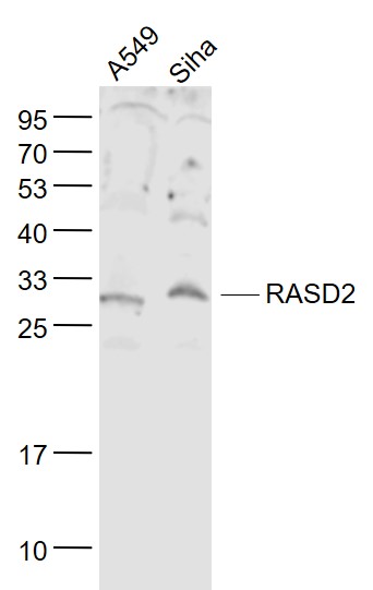 Lane 1: A549 cell lysates; Lane 2: Siha cell lysates probed with RASD2 Polyclonal Antibody, Unconjugated (bs-7006R) at 1:1000 dilution and 4˚C overnight incubation. Followed by conjugated secondary antibody incubation at 1:20000 for 60 min at 37˚C.