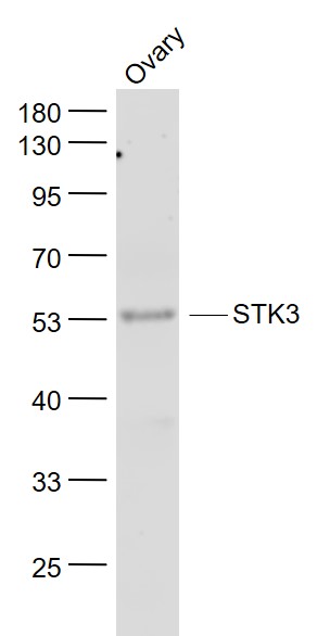 Mouse ovary lysates probed with STK3+STK4 Polyclonal Antibody, Unconjugated (bs-7599R) at 1:1000 dilution and 4˚C overnight incubation. Followed by conjugated secondary antibody incubation at 1:20000 for 60 min at 37˚C.