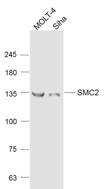 Lane 1: Molt-4 cell lysates; Lane 2: Siha cell lysates probed with SMC2 Polyclonal Antibody, Unconjugated (bs-7727R) at 1:1000 dilution and 4˚C overnight incubation. Followed by conjugated secondary antibody incubation at 1:20000 for 60 min at 37˚C.