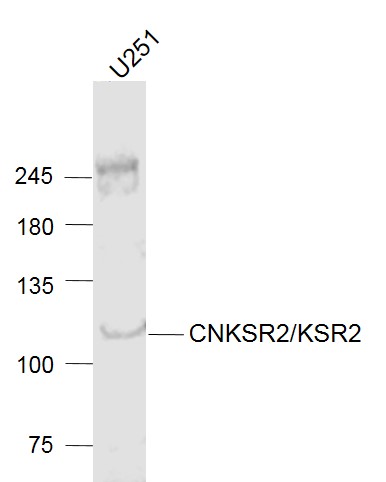 Human U251 cell lysates probed with CNKSR2 Polyclonal Antibody, Unconjugated (bs-8029R) at 1:1000 dilution and 4˚C overnight incubation. Followed by conjugated secondary antibody incubation at 1:20000 for 60 min at 37˚C.