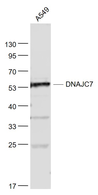 A549 cell lysates probed with DNAJC7 Polyclonal Antibody, Unconjugated (bs-8280R) at 1:1000 dilution and 4˚C overnight incubation. Followed by conjugated secondary antibody incubation at 1:20000 for 60 min at 37˚C.