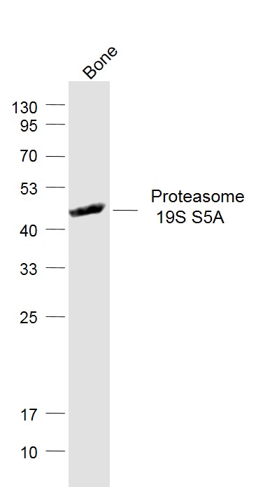 Mouse bone lysates probed with Proteasome 19S S5A Polyclonal Antibody, Unconjugated (bs-8322R) at 1:1000 dilution and 4˚C overnight incubation. Followed by conjugated secondary antibody incubation at 1:20000 for 60 min at 37˚C.