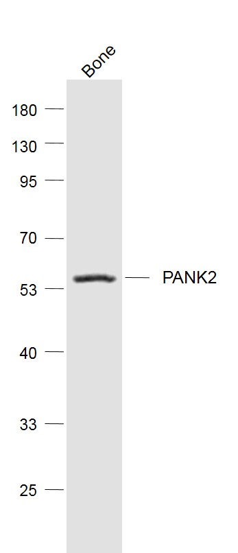 Mouse bone lysates probed with PANK2 Polyclonal Antibody, Unconjugated (bs-8338R) at 1:1000 dilution and 4˚C overnight incubation. Followed by conjugated secondary antibody incubation at 1:20000 for 60 min at 37˚C.