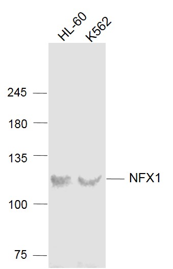 Lane 1: HL60 cell lysates; Lane 2: K562 cell lysates probed with NFX1 Polyclonal Antibody, Unconjugated (bs-8377R) at 1:1000 dilution and 4˚C overnight incubation. Followed by conjugated secondary antibody incubation at 1:20000 for 60 min at 37˚C.