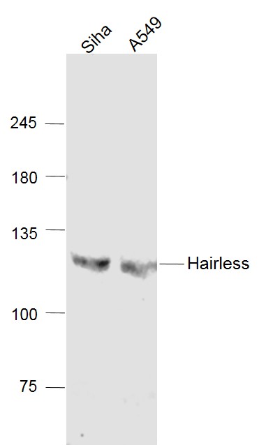 Lane 1: Siha cell lysates; Lane 2: A549 cell lysates probed with Hairless Polyclonal Antibody, Unconjugated (bs-8507R) at 1:1000 dilution and 4˚C overnight incubation. Followed by conjugated secondary antibody incubation at 1:20000 for 60 min at 37˚C.