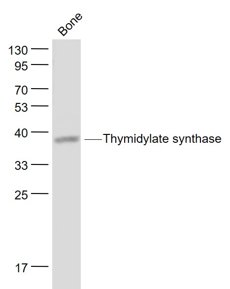 Mouse bone lysates probed with Thymidylate synthase Polyclonal Antibody, Unconjugated (bs-8537R) at 1:1000 dilution and 4˚C overnight incubation. Followed by conjugated secondary antibody incubation at 1:20000 for 60 min at 37˚C.