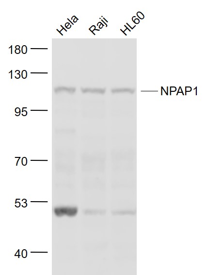 Lane 1: Hela cell lysates; Lane 2:Raji cell lysates; Lane 3: HL60 cell lysates probed with NPAP1 Polyclonal Antibody, Unconjugated (bs-9625R) at 1:1000 dilution and 4˚C overnight incubation. Followed by conjugated secondary antibody incubation at 1:20000 for 60 min at 37˚C.