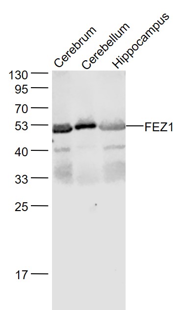 Lane 1: Mouse Cerebrum lysates; Lane 2: Mouse Cerebellum lysates; Lane 3: Mouse Hippocampus lysates probed with FEZ1 Polyclonal Antibody, Unconjugated (bs-9721R) at 1:1000 dilution and 4˚C overnight incubation. Followed by conjugated secondary antibody incubation at 1:20000 for 60 min at 37˚C.