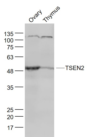 Lane 1: Mouse Ovary lysates; Lane 2: Mouse Thymus lysates probed with TSEN2 Polyclonal Antibody, Unconjugated (bs-9735R) at 1:1000 dilution and 4˚C overnight incubation. Followed by conjugated secondary antibody incubation at 1:20000 for 60 min at 37˚C.