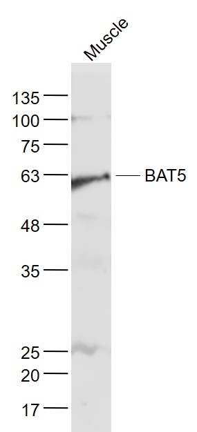 Lane 1: Skeletal muscle lysates probed with BAT5 Polyclonal Antibody, Unconjugated (bs-9757R) at 1:1000 dilution and 4˚C overnight incubation. Followed by conjugated secondary antibody incubation at 1:20000 for 60 min at 37˚C.