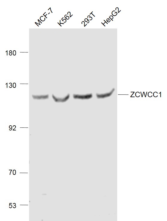 Lane 1: MCF-7 cell lysates; Lane 2: K562 cell lysates; Lane 3: 293T cell lysates; Lane 4: HepG2 cell lysates probed with ZCWCC1 (Ser739) Polyclonal Antibody, Unconjugated (bs-10016R) at 1:1000 dilution and 4˚C overnight incubation. Followed by conjugated secondary antibody incubation at 1:20000 for 60 min at 37˚C.