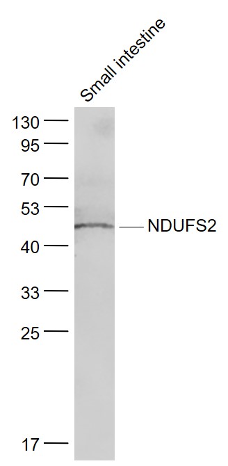Lane 1: Small intestine lysates probed with NDUFS2 Polyclonal Antibody, Unconjugated (bs-10455R) at 1:1000 dilution and 4˚C overnight incubation. Followed by conjugated secondary antibody incubation at 1:20000 for 60 min at 37˚C.