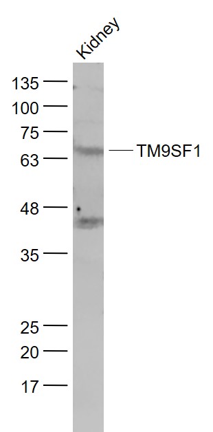 Lane 1: Kindey lysates probed with TM9SF1 Polyclonal Antibody, Unconjugated (bs-10764R) at 1:1000 dilution and 4˚C overnight incubation. Followed by conjugated secondary antibody incubation at 1:20000 for 60 min at 37˚C.